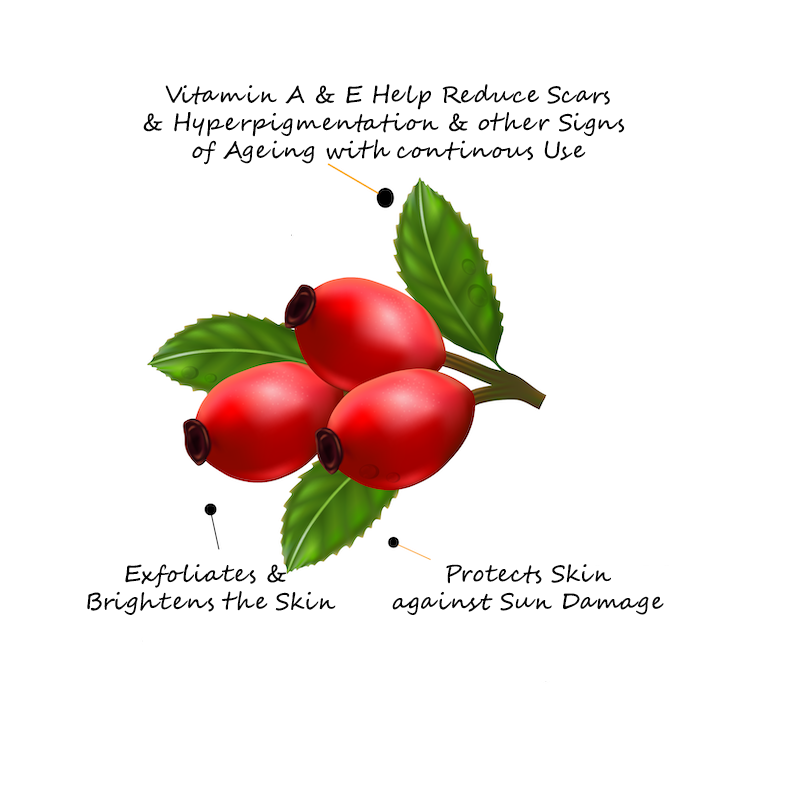 Rosehip Oil - Cold Pressed for Hyper-pigmentation | Non Sticky | Non Greasy | Boosts Skin Radiance