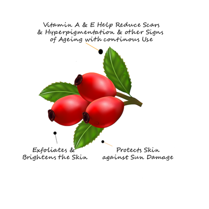 Rosehip Oil - Cold Pressed for Hyper-pigmentation | Non Sticky | Non Greasy | Boosts Skin Radiance