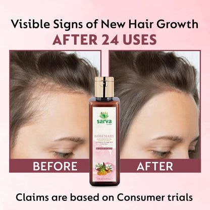 Rosemary Hair Oil
Anti-Hairfall Oil
Hair Regrowth Treatment
Natural Hair Growth
Strengthening Hair Oil
Sulfate-Free Shampoo
Best Shampoo for Hair Growth
Shampoo for Hair Fall Control
Natural Hair Shampoo
Shampoo for Low Porosity Hair